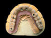 Tono dental 3