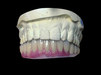Tono dental 5